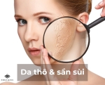 Da khô và sần sùi: Bật mí cách khắc phục từ chuyên gia