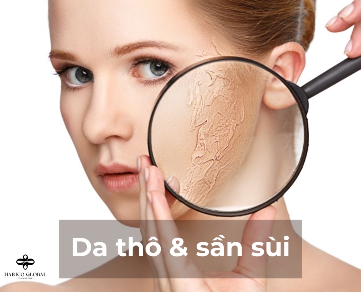 Da khô và sần sùi: Bật mí cách khắc phục từ chuyên gia